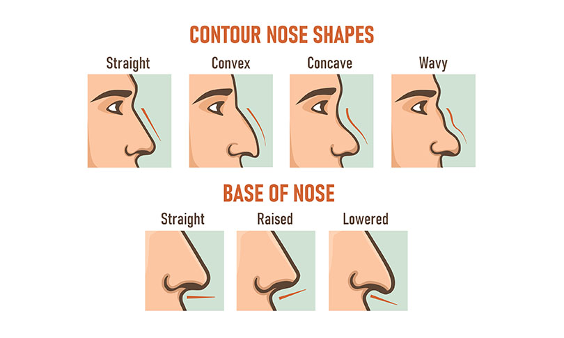 type nose rhinoplasty help
