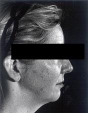 bna-face b1