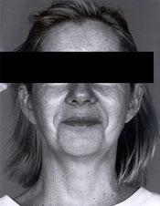 bna-face b2