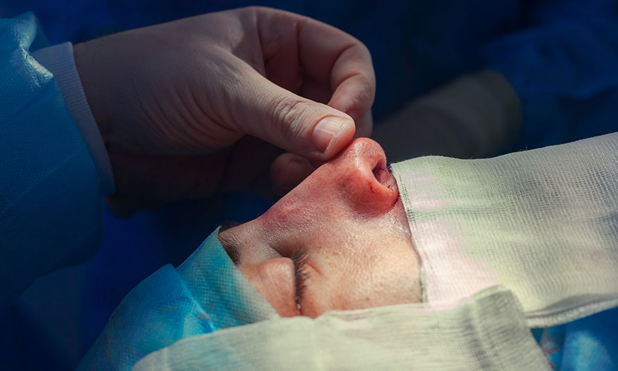 botched nosejob